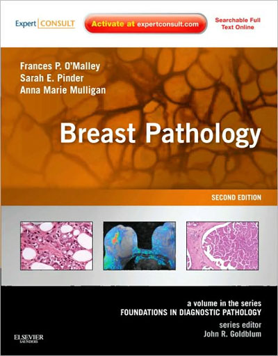 Breast Pathology, Second edition