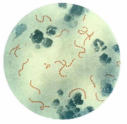 bacteria that causes pneumonia