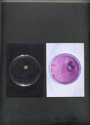 anaerobic gram negative bacteria